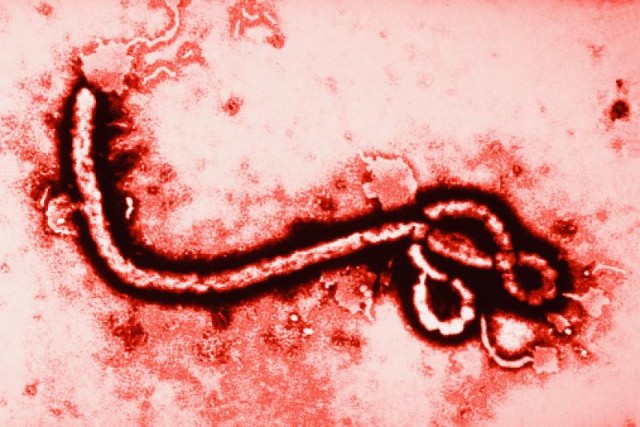 27 Juni 1976, Dunia Saksikan Lahirnya Virus Ebola